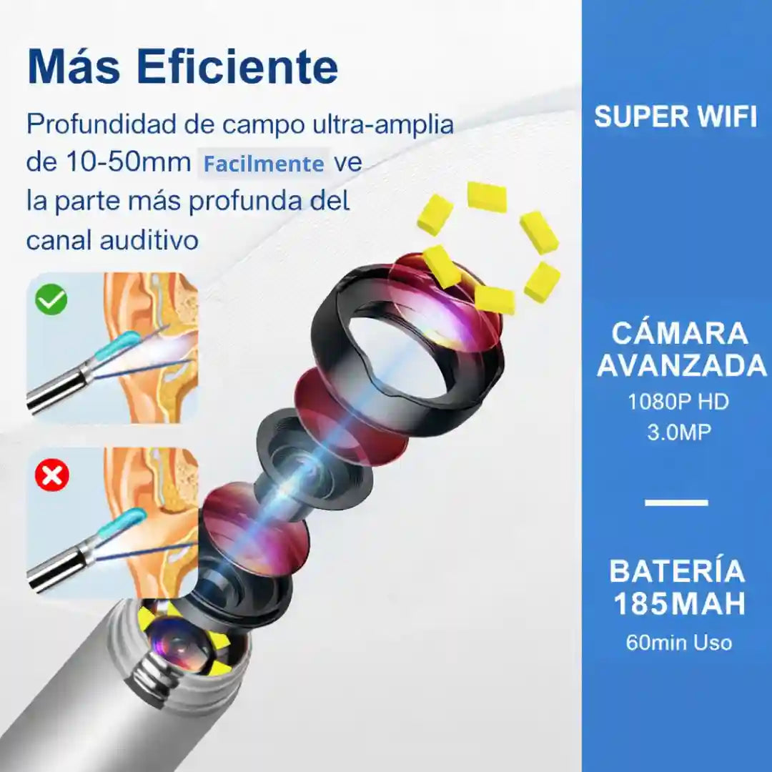 ClearView® Pro – Limpia Oídos con Cámara HD y Control Visual Total