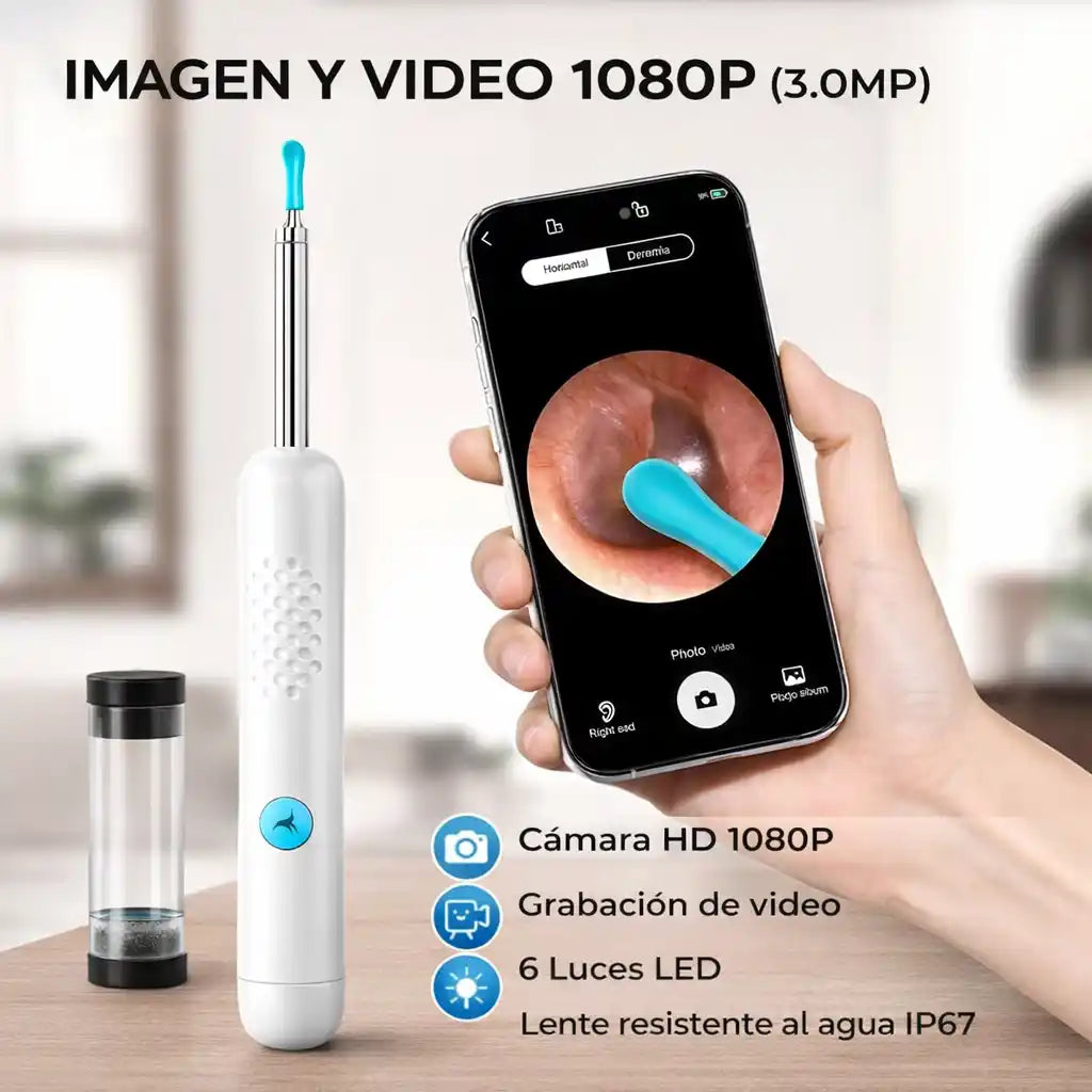 ClearView® Pro – Limpia Oídos con Cámara HD y Control Visual Total