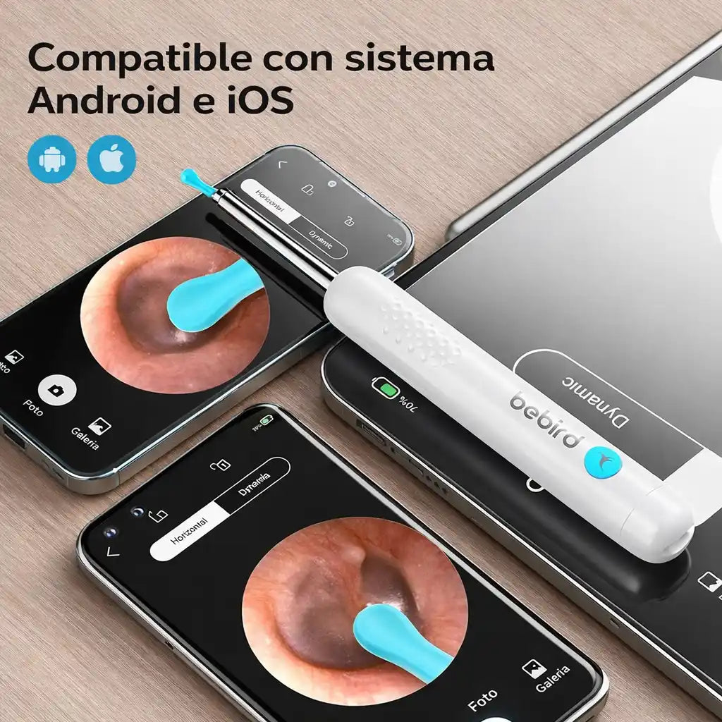 ClearView® Pro – Limpia Oídos con Cámara HD y Control Visual Total